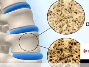 童年骨科回忆录：从小到大的骨骼健康故事